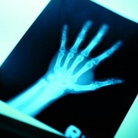 沈阳收购x光片 收购CT片子 沈阳回收医院废旧片子