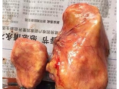 鸡宝出售玻璃私人直接收购鸡宝