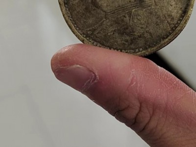 有三个袁大头处理图2